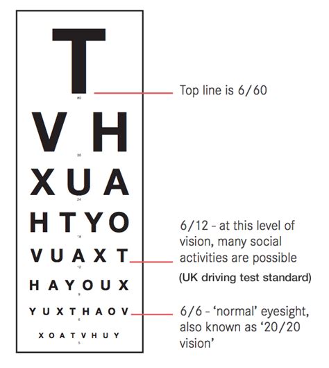 Your Eye Test Explained .